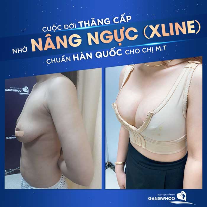 nang nguc line