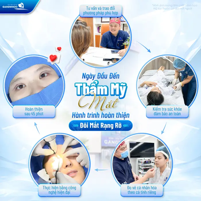 Cắt Mí 4 In 1 Plasma Khắc Phục Mọi Khuyết Điểm, Mắt 2 Mí Đẹp Hoàn Hảo 7 Quy trình từ đôi mắt chưa hoàn hảo đên ánh nhìn đẹp hoàn thiện tại bệnh viện thẩm mỹ Gangwhoo