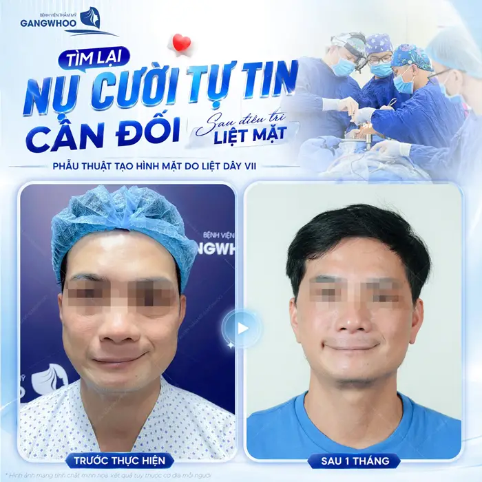 Tìm lại nụ ucời tự tin gương mặt và đường nét thêm cân đối và hài hòa sau khi điều trị 