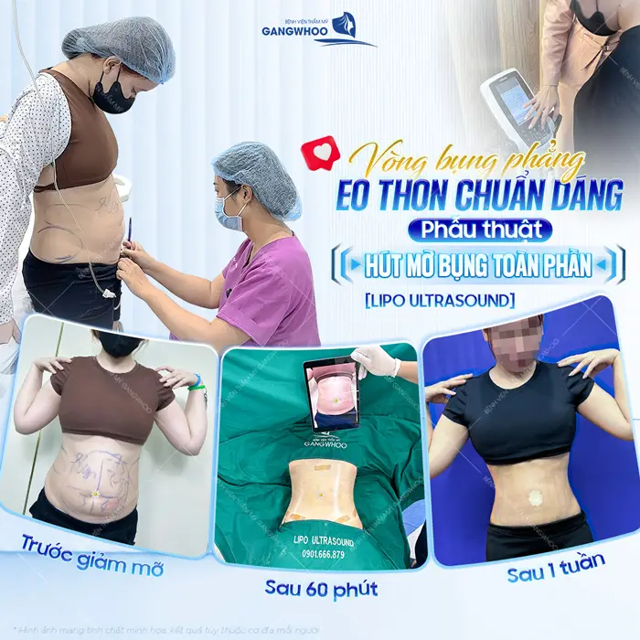 Vòng bụng phẳng eo thon chuẩn dáng sự thay đổi có thể nhìn thấy bằng mắt thường chỉ sau 1 tuần thực hiện