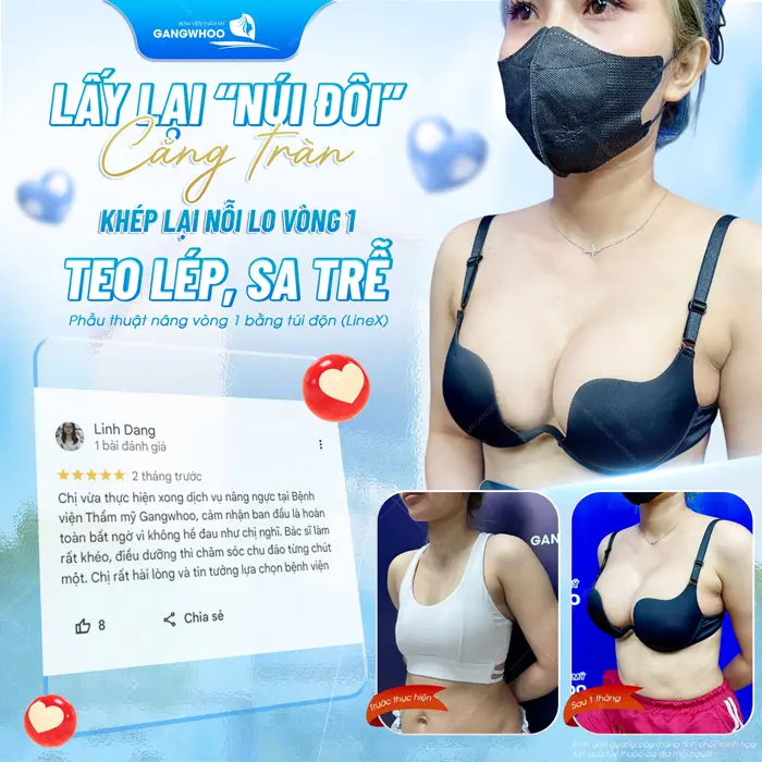 phau thuat nang vong 1 bang tui don khach hang hai long va danh gia tot ve chat luong va dich vu