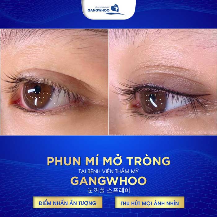 phun mi mo trong