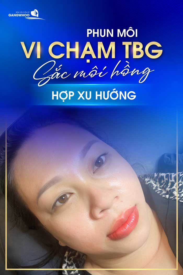 phun moi vi cham