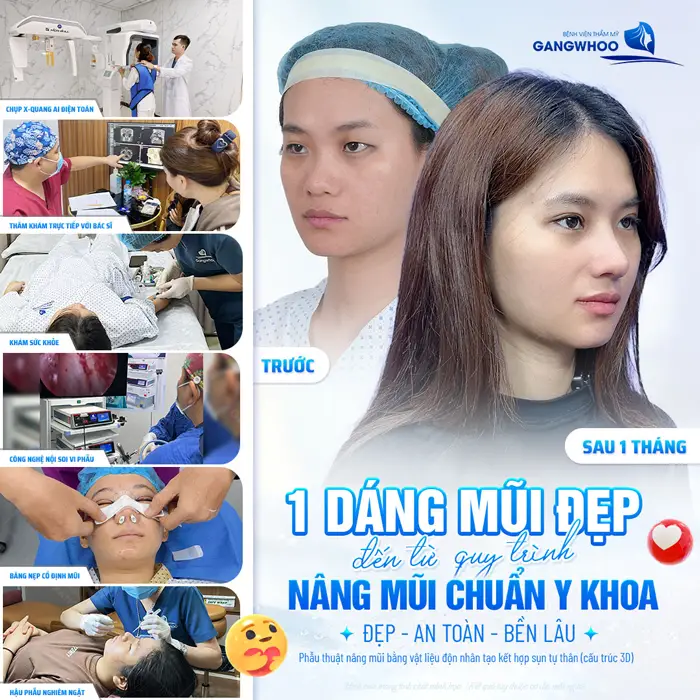 1 dáng mũi đẹp chẩun đế từ quy trình nâng mũi chuẩn y khoa mũi cao hài hòa và đẹp dài lâu 