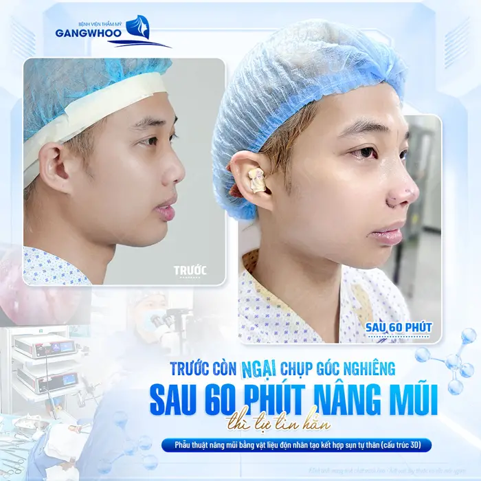 Sau 60 phút nâng mũi góc nghiêng đã hoàn toàn thay đổi khác biệt từ thấp bè đến cao bay hoàn hảo