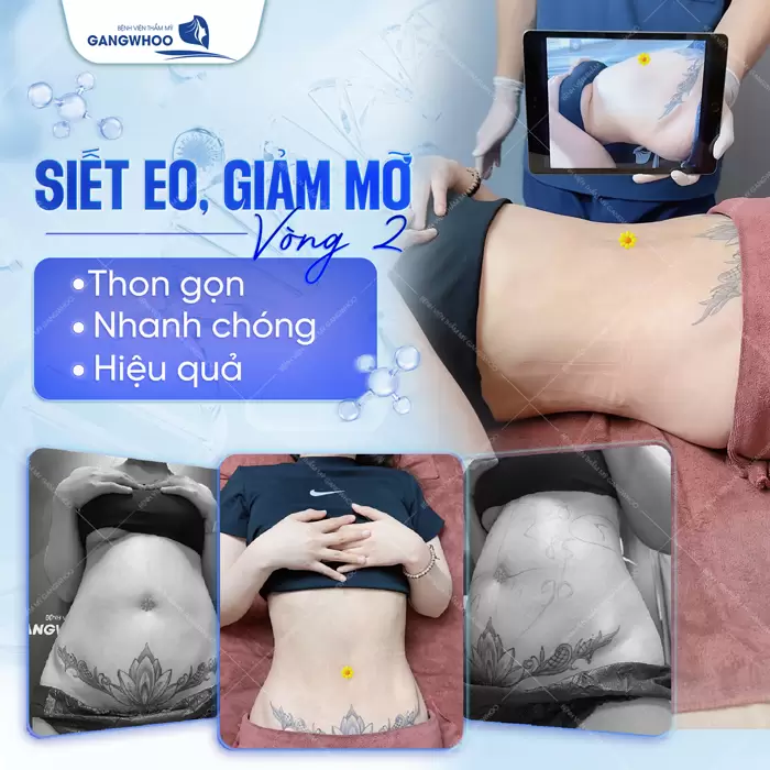 Lipo Ultrasound: Công Nghệ Hút Mỡ Được Nhiều Khách Quốc Tế Lựa Chọn 43 siet eo vong 2 dep thon gon thu hut
