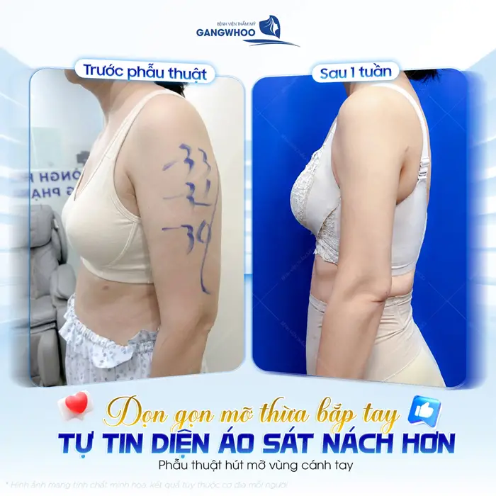 Tự tin diện áo sát nách hơn kết quả thay đổi đầy bất ngờ sau 1 tuần thực hiện 
