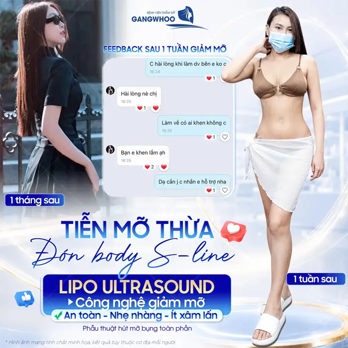 tam biet mo thua don duong cong s line voi cong nghe giam mo bung lipo ultrasound