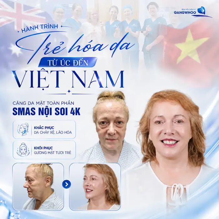 Giới Thiệu Bệnh Viện Thẩm Mỹ Gangwhoo - Bệnh viện Chuẩn Hàn 11 Hành trình trẻ hóa da từ Úc đến Việt Nam sau căng da mặt Smas nội soi 4K khắc phục da chảy xệ, khôi phục gương mặt đẹp tươi trẻ