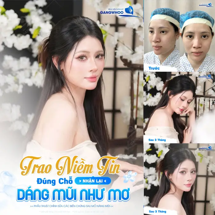 Trao niềm tin đúng chỗ nhận lại dáng mũi đẹp như mơ