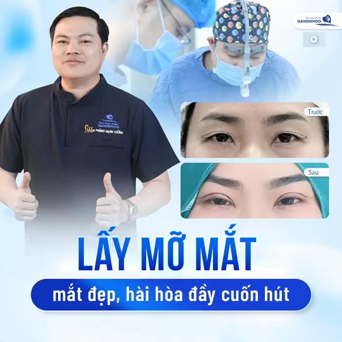 Tái Tạo Mỡ Mắt Giữ Mãi Nét Thanh Xuân Cho Đôi Mắt Biết Cười