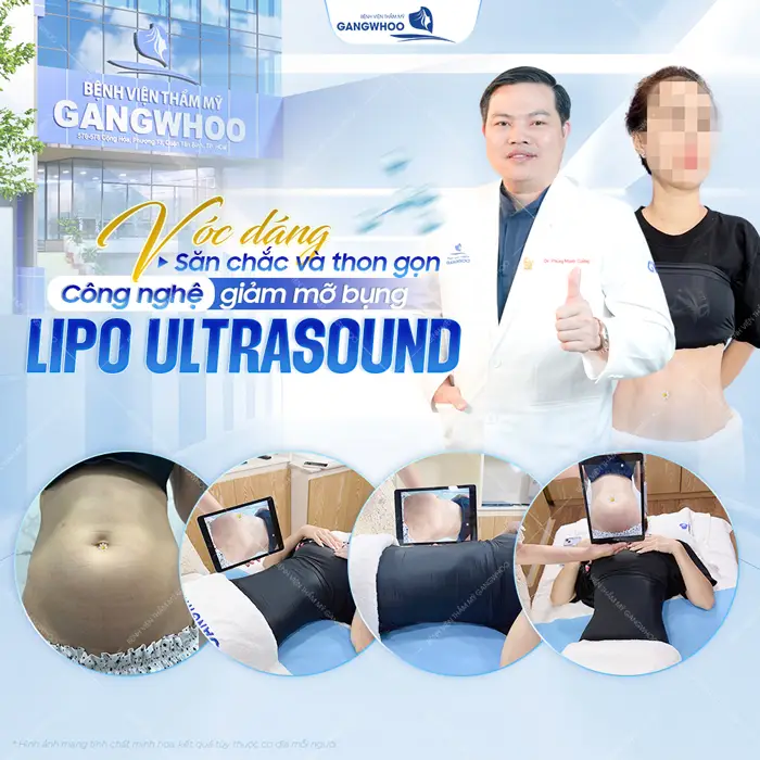 Vóc dáng đẹp săn chắc và thon gọn với công nghệ giảm mỡ bụng (Lipo Ultrasound)