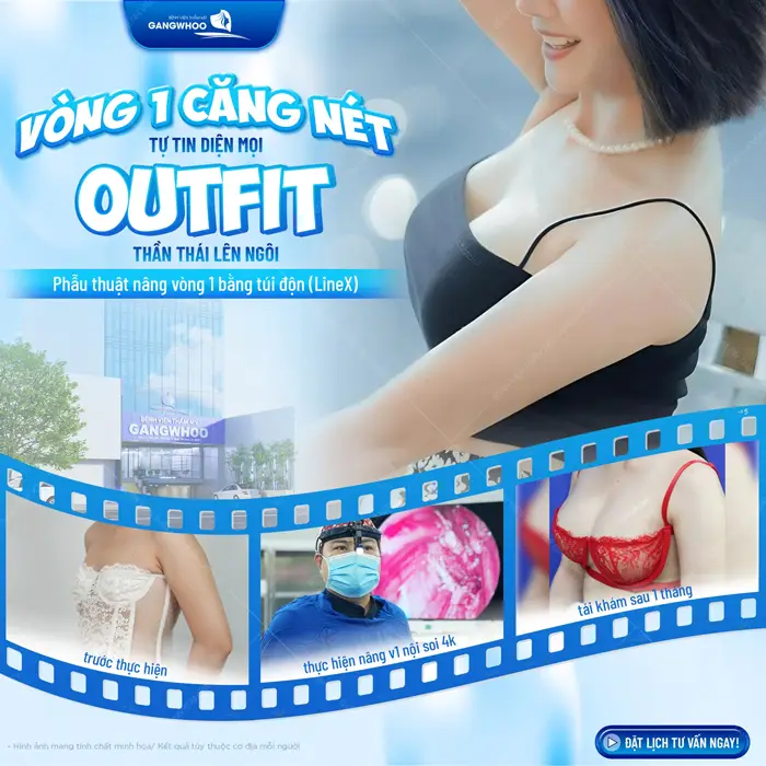 Phẫu Thuật Nâng Ngực: Chỉ Định, Quy Trình Và Bảng Giá 2026 6 Vòng 1 căng đét tự tin diện mọi outfỉ thần thái lên ngôi với công nghệ hỗ trợ hiện đại