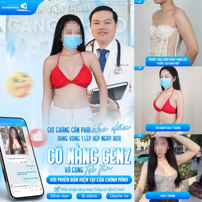 Phẫu Thuật Nâng Ngực: Chỉ Định, Quy Trình Và Bảng Giá 2026 6 Vòng 1 căng tròn, body đẹp quyến rũ sau ngày càng sexy và quyến rũ vượt hơn cả mong đợi