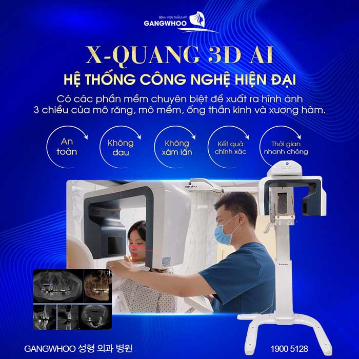 Những khách hàng nâng mũi đều được chụp X-quang AI điện toán