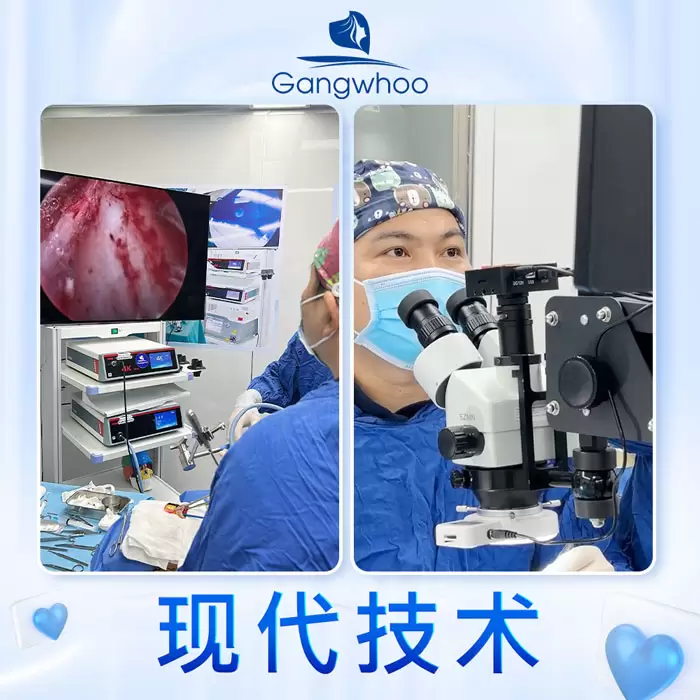 zh lay mo mat noi soi 5