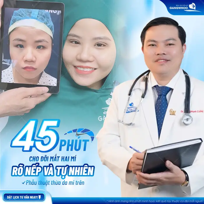 Chỉ 45 phút thực hiện đôi mắt đã vào nếp đầy tự nhiên và cuốn hút