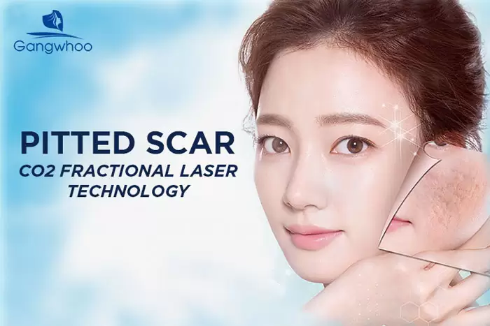 CO2 fractional laser
