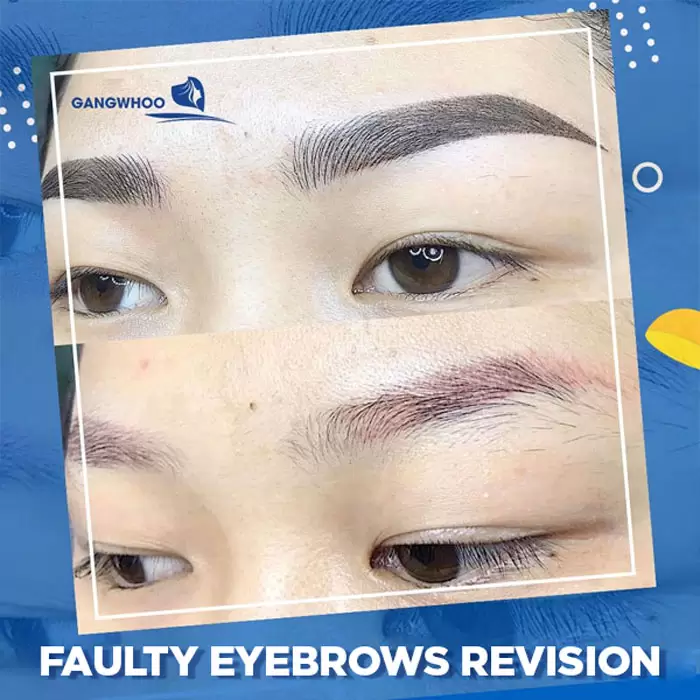 Faded Ink Brow Fix - The Absolute Method Of Correcting Faulty Brows 3 brow revision 1