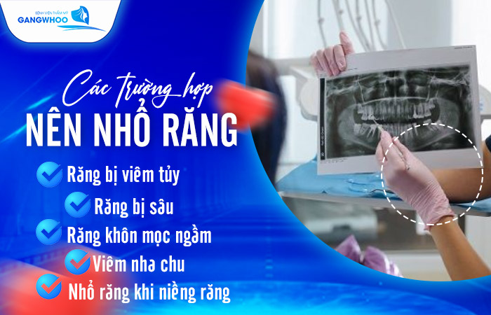 Công Nghệ Nhổ Răng Siêu Âm: Quy Trình, Chi Phí Mới - 1 Nhổ Răng