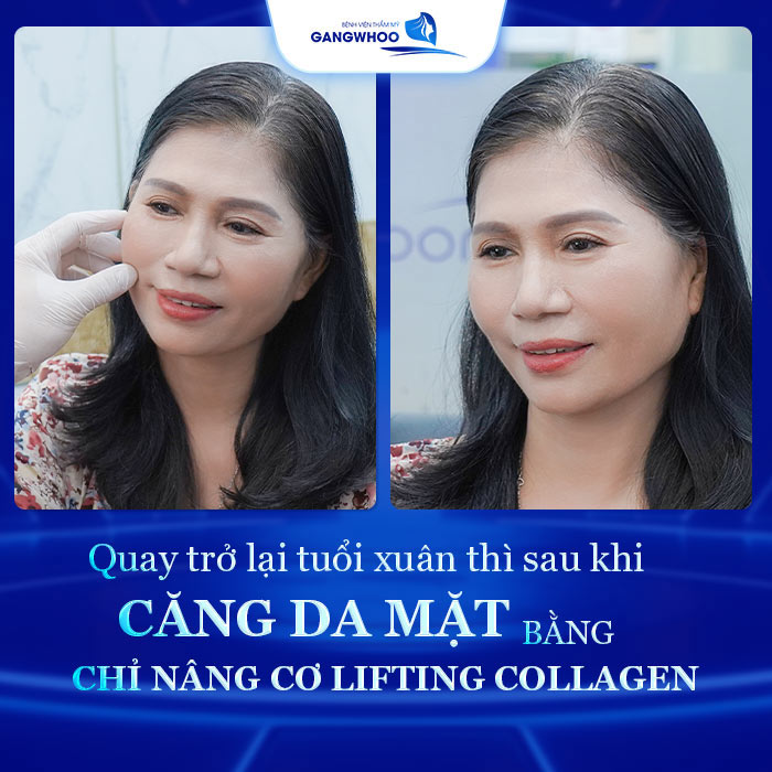 cang da mat bang chi nang co quay tro lai tuoi