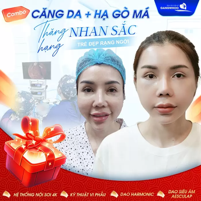 Bảng Giá Phẫu Thuật Thẩm Mỹ Làm Đẹp Tại Bệnh Viện Thẩm Mỹ Gangwhoo 3 cang da mat ha go ma thang hang nhan sac tuyet voi