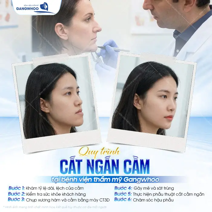 cat ngan cam 2