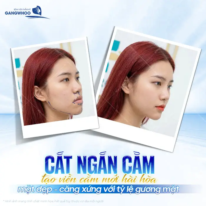 Cắt ngắn cằm tạo viền mới hài hòa mặt đẹp, căng xứng với tỷ lệ gương mặt 