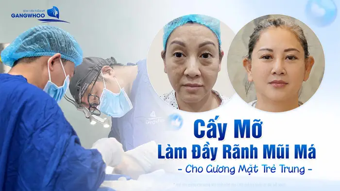 cay mo lam day ranh mui ma