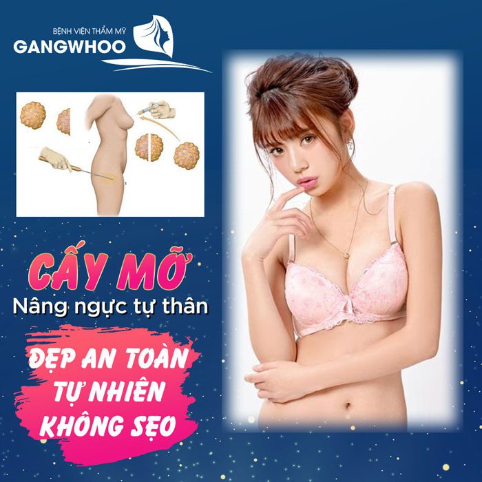 Cấy mỡ nâng ngực là phương pháp sử dụng mỡ tự thân để bơm vào vùng ngực bị thiếu hụt mỡ