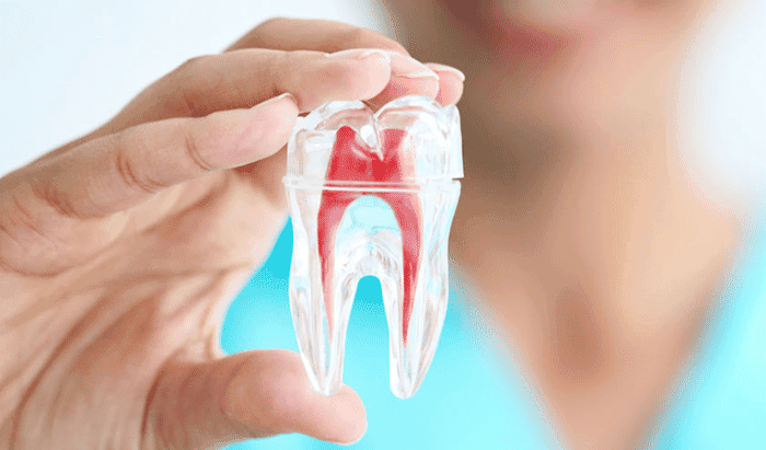 Root Canal Treatment (Internal)