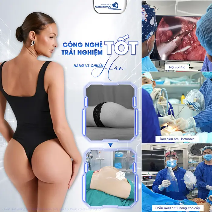 Nâng Mông Nội Soi "Tôn Vinh Vòng 3 Căng Tròn Quyến Rũ" 6 Công nghệ tốt, trải nghiệm tốt khi nâng cấp vòng 3 tại bệnh viện thẩm mỹ Gangwhoo
