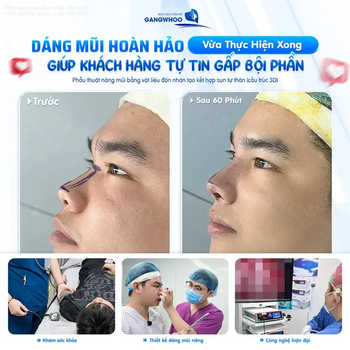 Dáng mũi hoàn hảo vừa thực hiện xong giúp khách hàng tự tin gấp bội phần 