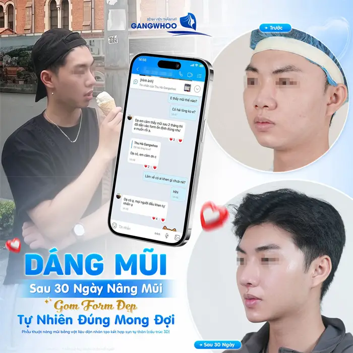 dang mui sau 30 ngay nang mui gom form mem mai tu nhien dep nhu mong doi