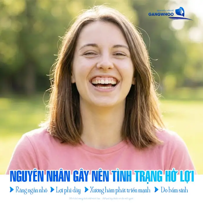 Điều Trị Cười Hở Lợi Cho Nụ Cười Quyến Rũ, Đẹp Tự Nhiên