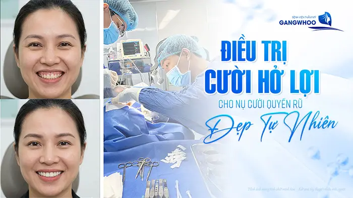 dieu tri cuoi ho loi