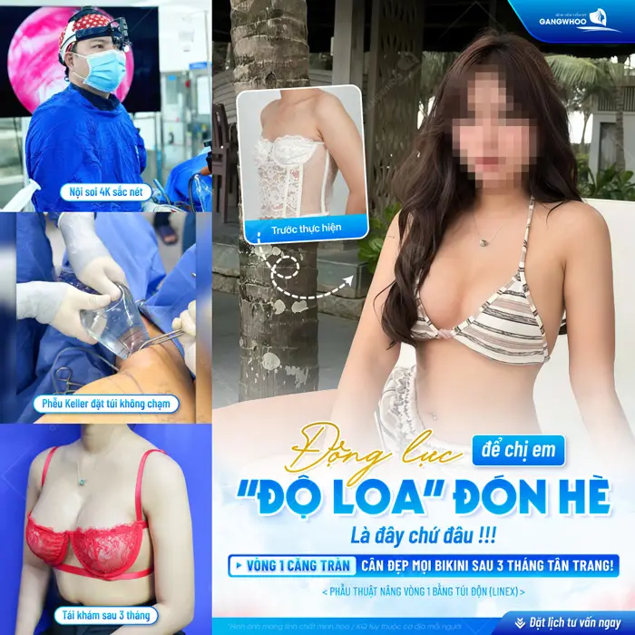 Động lực để chị em "độ loa" đón hè vòng 1 căng tròn đẹp chuẩn dáng sau 3 tháng can thiệp 
