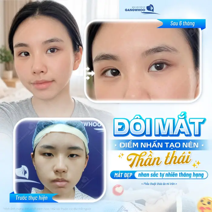 Đôi mắt điểm nhấn tạo nên thần thái cho đôi mắt đẹp nhan sắc đẹp chuẩn tự nhiên và thăng hạng