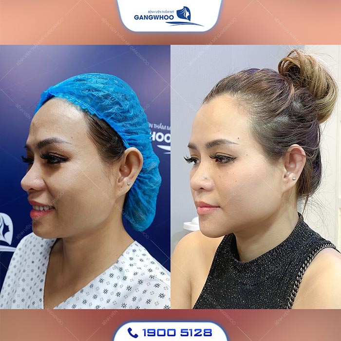 don cam duy tri lau dai