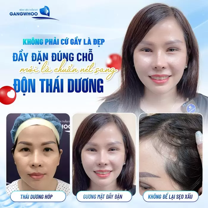 Độn Thái Dương Sở Hữu Gương Mặt Thanh Tú Đầy Sức Sống 1 Độn Thái Dương Sở Hữu Gương Mặt Thanh Tú Đầy Sức Sống