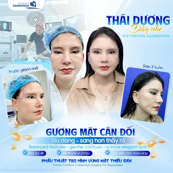 Độn Thái Dương Sở Hữu Gương Mặt Thanh Tú Đầy Sức Sống