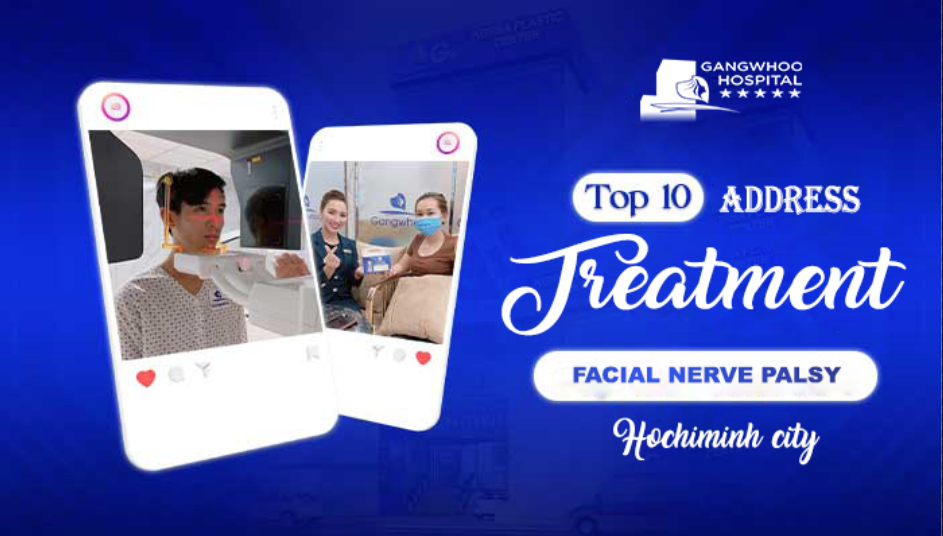 Facial Nerve Palsy