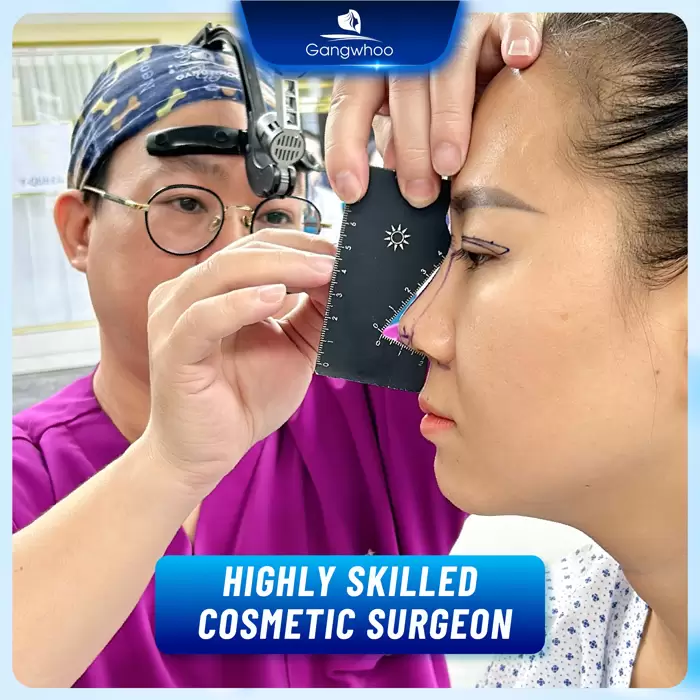 Nanoform Rhinoplasty - Becoming The Center Of Attention 7 en bs tay nghe cao duoc kh tin tuong