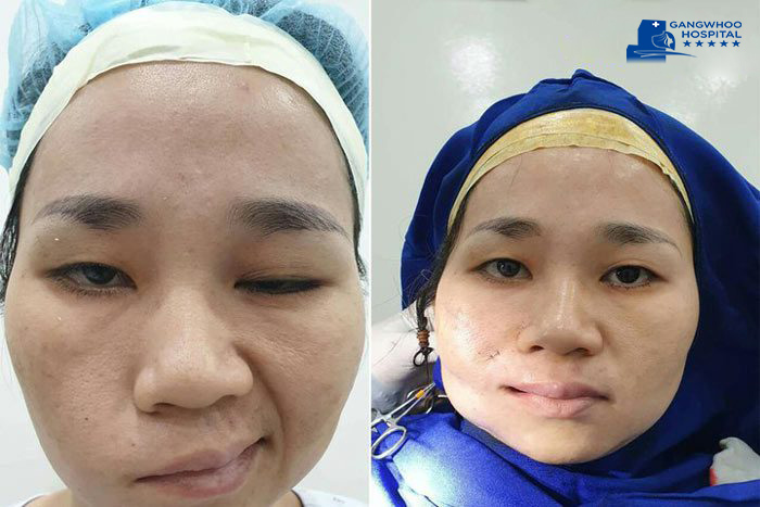 en dia chi chua liet day than kinh so 7 bvtm gangwhoo 1