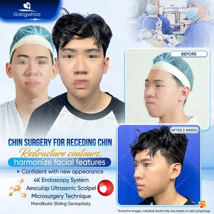 en dieu tri khop can 2