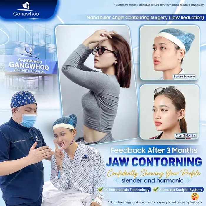 en dieu tri khop can 3