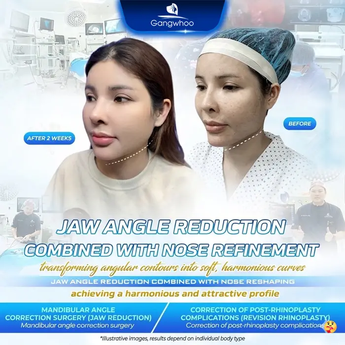 en dieu tri khop can 4