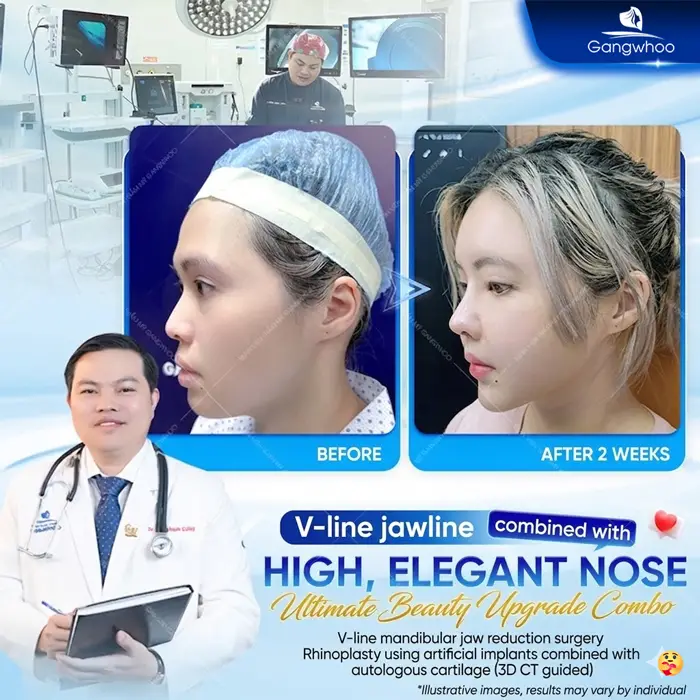 en dieu tri khop can 5