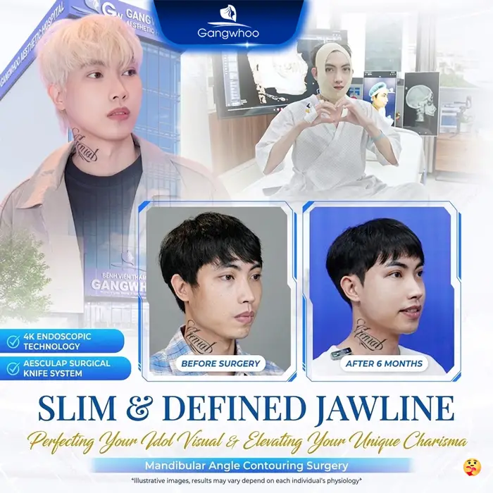 en dieu tri khop can 6