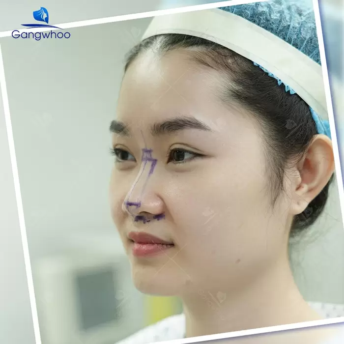 en nang mui nanoform 2